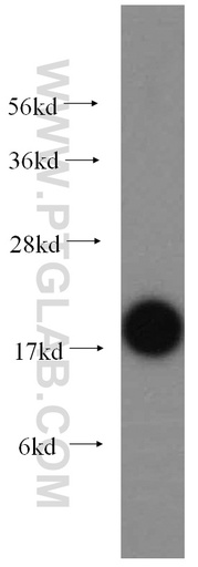 [10070-1-AP-150UL] UBC9 Polyclonal antibody