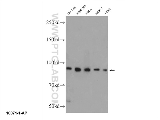 [10071-1-AP-150UL] ELAC2 Polyclonal antibody