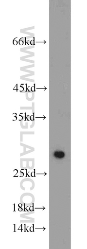 [10099-1-AP-150UL] SIRT3 Polyclonal antibody