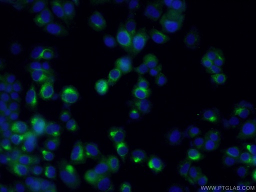 [10111-1-AP-150UL] NUMBL Polyclonal antibody