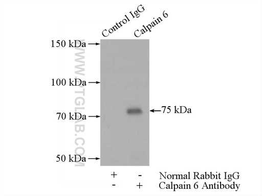 [10120-1-AP-150UL] Calpain 6 Polyclonal antibody