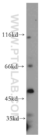 [10129-2-AP-20UL] NFYC Polyclonal antibody