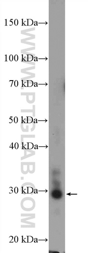 [10131-1-AP-150UL] FUSIP1 Polyclonal antibody