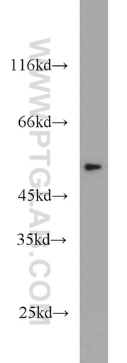 [10139-1-AP-150UL] THRA Polyclonal antibody