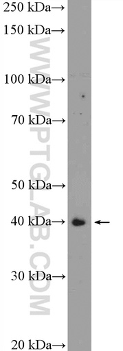 [10145-1-AP-150UL] TMOD1 Polyclonal antibody
