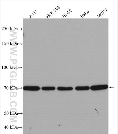 [13073-1-AP-150UL] 15 Lipoxygenase 2 Polyclonal antibody