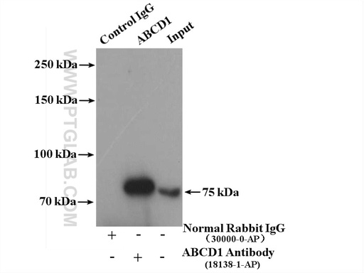 [18138-1-AP-150UL] ABCD1 Polyclonal antibody