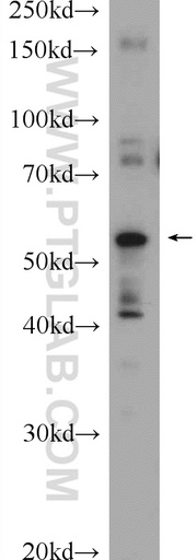 [22526-1-AP-150UL] ABHD15 Polyclonal antibody