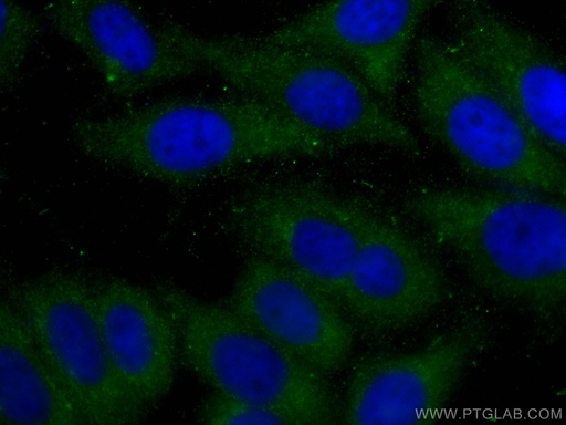 [67779-1-IG-150UL] ABHD5 Monoclonal antibody