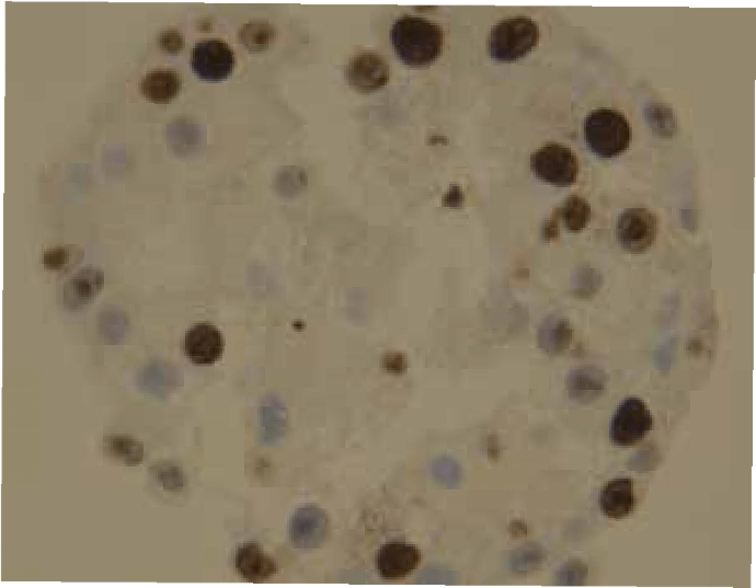 Cells are positive for cell proliferation marker KI67