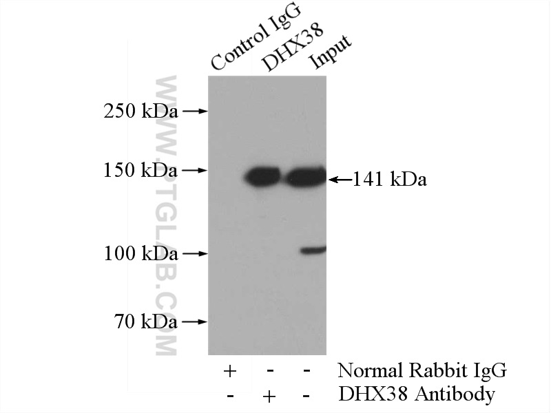 DHX38 Polyclonal antibody