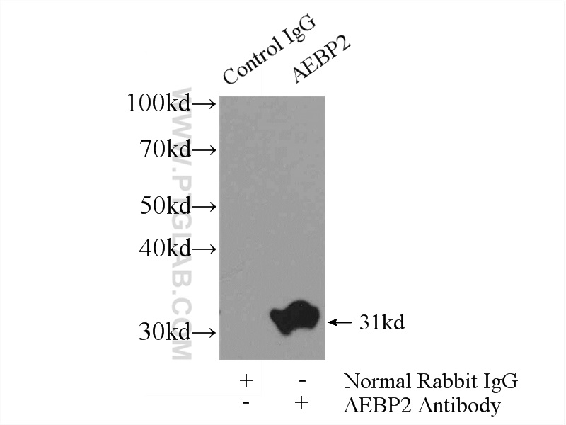 AEBP2 Polyclonal antibody