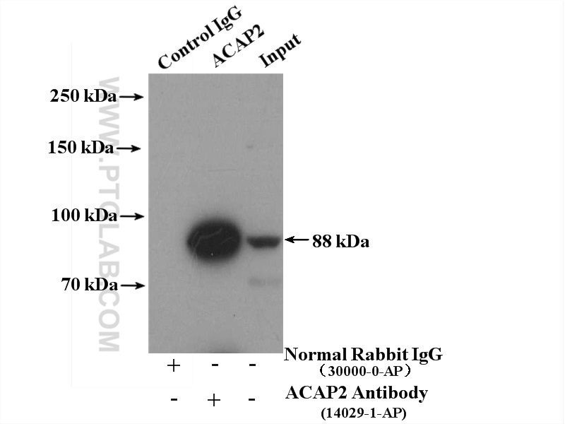 ACAP2 Polyclonal antibody