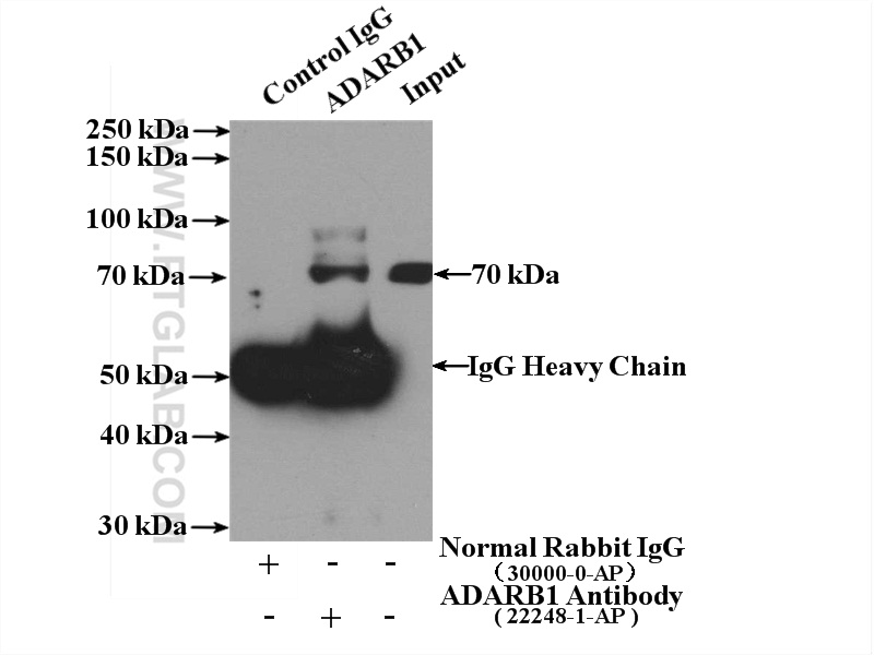 ADARB1 Polyclonal antibody