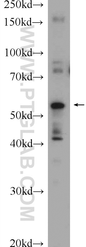 ABHD15 Polyclonal antibody