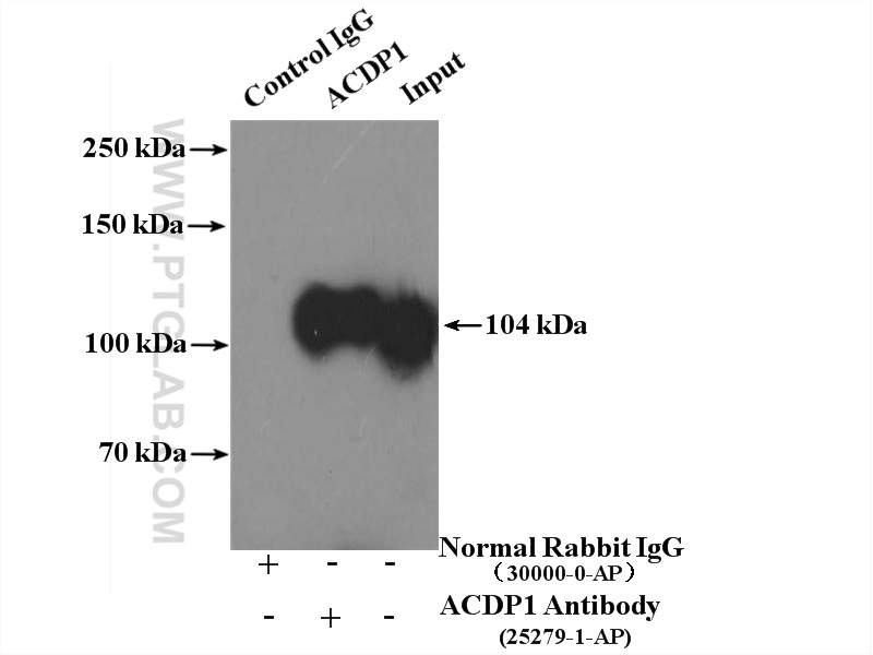 ACDP1 Polyclonal antibody