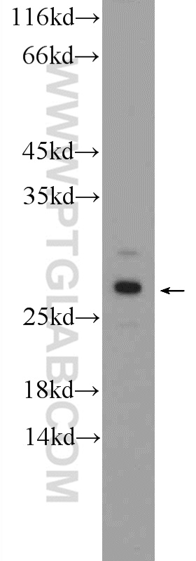 AGPHD1 Polyclonal antibody