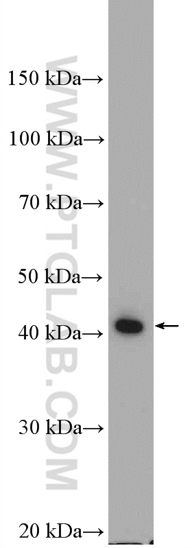 ABHD1 Polyclonal antibody