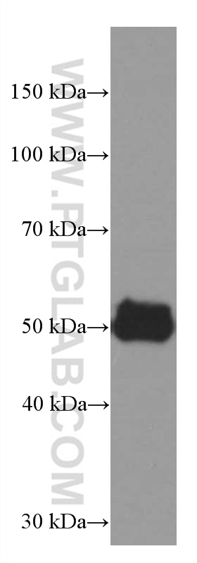 AGTR1 Monoclonal antibody