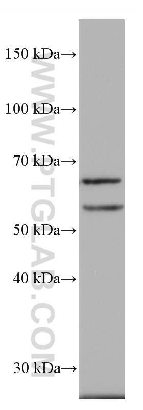 ACVRL1 Monoclonal antibody