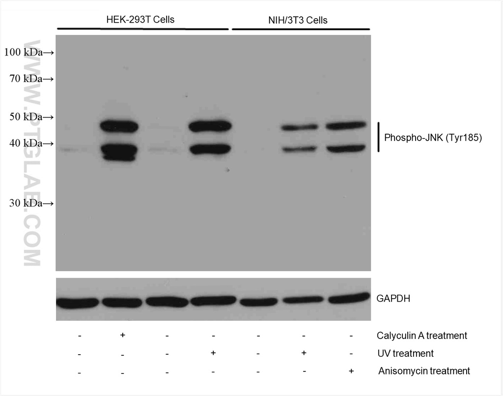 Phospho-JNK (Tyr185) Recombinant antibody