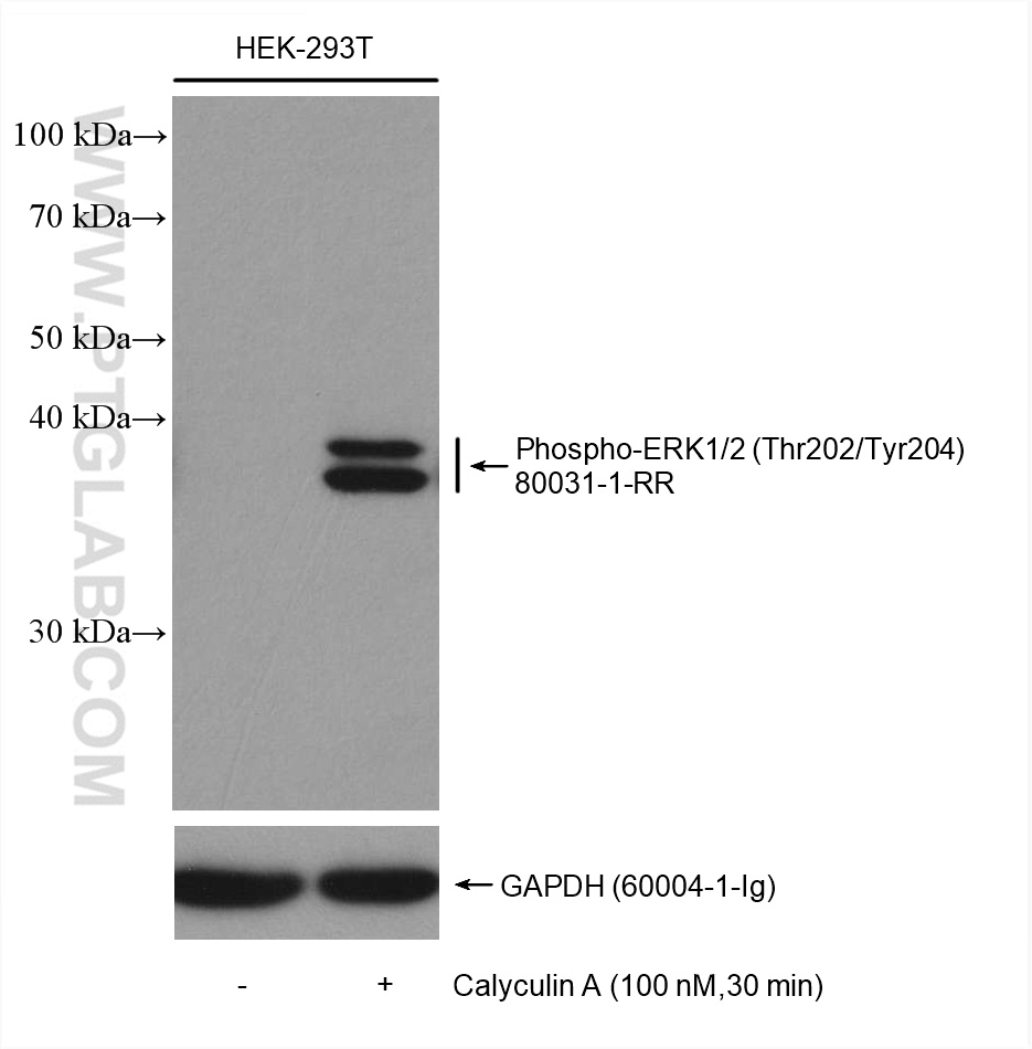 Phospho-ERK1/2 (Thr202/Tyr204) Recombinant antibody