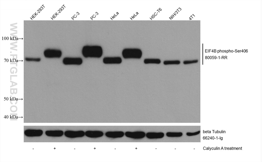 Phospho-EIF4B (Ser406) Recombinant antibody