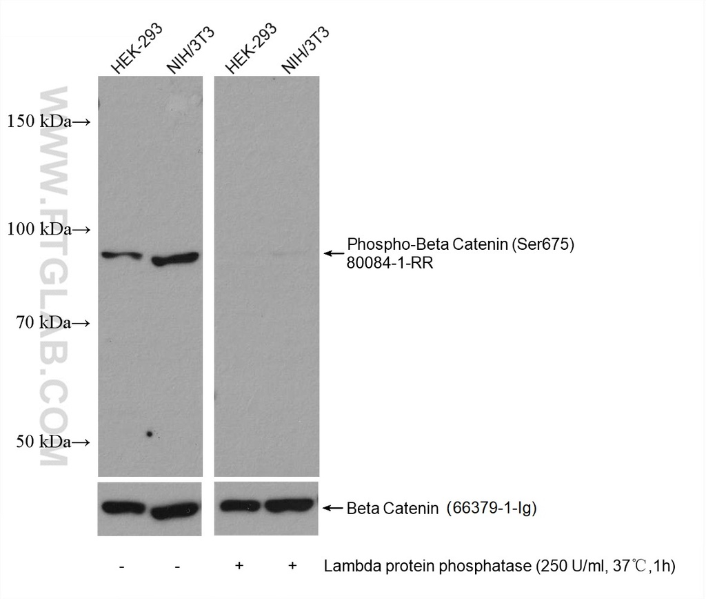 Phospho-Beta Catenin (Ser675) Recombinant antibody