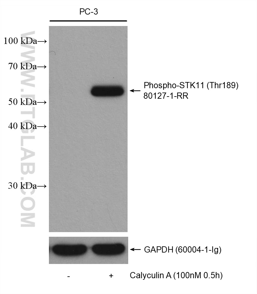 Phospho-STK11 (Thr189) Recombinant antibody