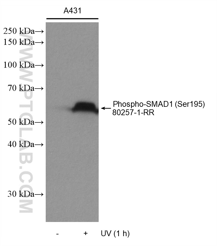 Phospho-SMAD1 (Ser195) Recombinant antibody