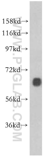 [10002-2-AP-150UL] Marcksl1 Polyclonal antibody