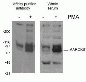 [10018-3-AP-100UL] Phospho-Marcks Polyclonal antibody