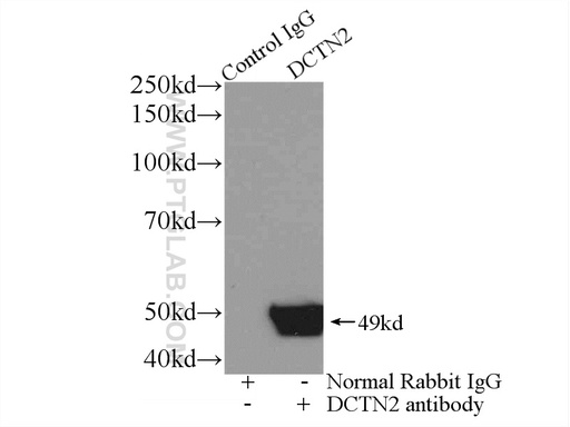 [10031-2-AP-150UL] Dynamitin (1-83 AA) Polyclonal antibody