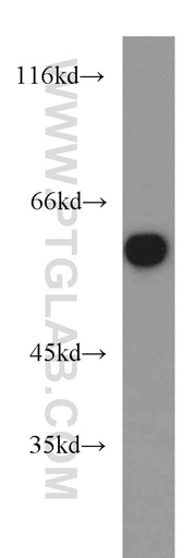 [10036-2-AP-150UL] MAPK7 Polyclonal antibody