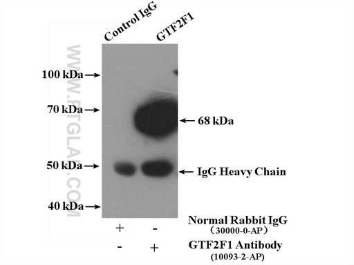 [10093-2-AP-150UL] GTF2F1 Polyclonal antibody