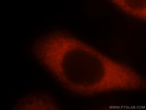[10095-2-AP-150UL] EEF1B2 Polyclonal antibody