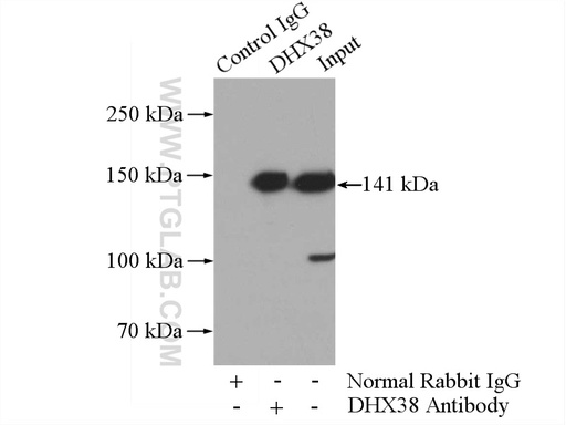 [10098-2-AP-150UL] DHX38 Polyclonal antibody