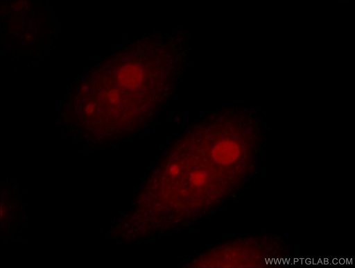 [10282-1-AP-20UL] AATF Polyclonal antibody