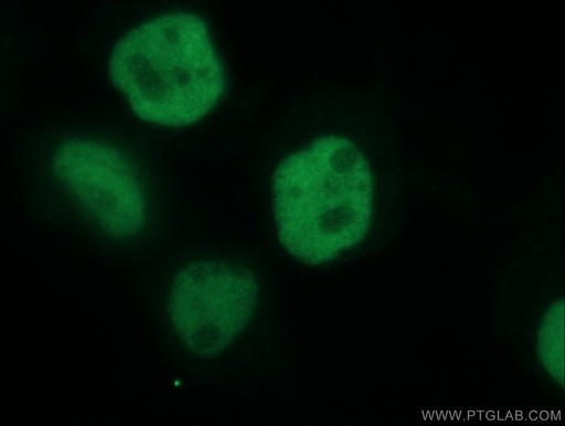 [12143-1-AP-150UL] p63 Polyclonal antibody