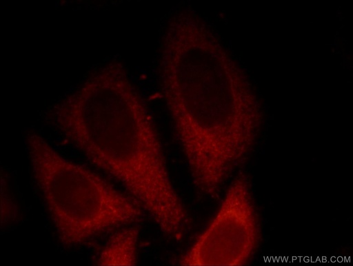 [12180-1-AP-150UL] p120 Catenin Polyclonal antibody