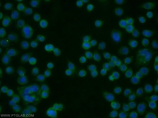 [14021-1-AP-150UL] AADACL1 Polyclonal antibody