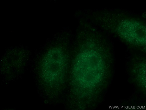 [14064-1-AP-150UL] p38 MAPK Polyclonal antibody