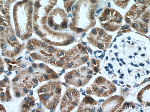 [14900-1-AP-150UL] AARSD1 Polyclonal antibody