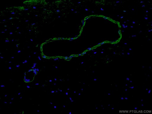 [55135-1-AP-150UL] smooth muscle actin-specific Polyclonal antibody