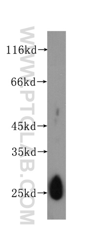 [60158-1-IG-150UL] luciferase Monoclonal antibody