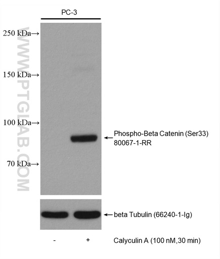 [80067-1-RR-100UL] Phospho-Beta Catenin (Ser33) Recombinant antibody