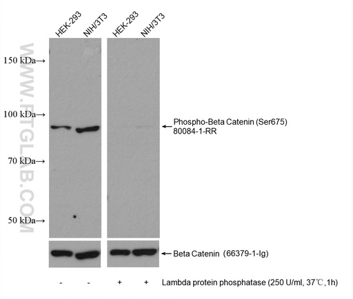 [80084-1-RR-100UL] Phospho-Beta Catenin (Ser675) Recombinant antibody