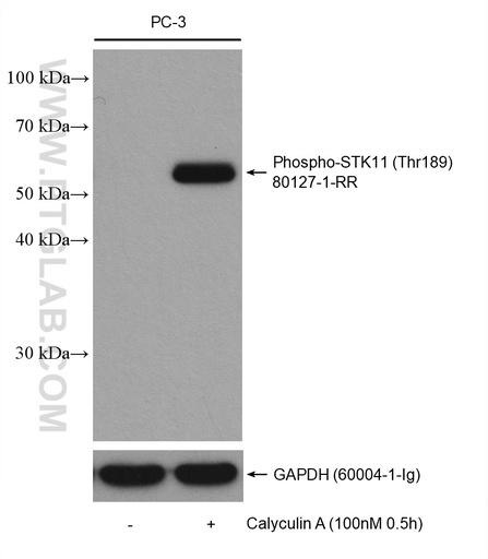 [80127-1-RR-100UL] Phospho-STK11 (Thr189) Recombinant antibody