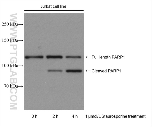 [80174-1-RR-100UL] PARP1 Recombinant antibody