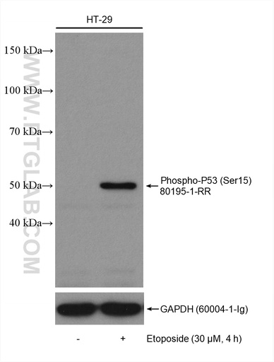[80195-1-RR-100UL] Phospho-P53 (Ser15) Recombinant antibody
